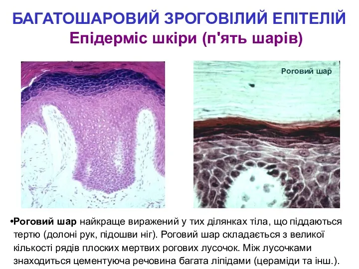 БАГАТОШАРОВИЙ ЗРОГОВІЛИЙ ЕПІТЕЛІЙ Епідерміс шкіри (п'ять шарів) Роговий шар найкраще