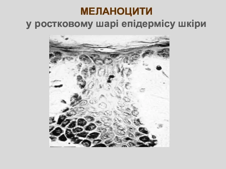 МЕЛАНОЦИТИ у ростковому шарі епідермісу шкіри