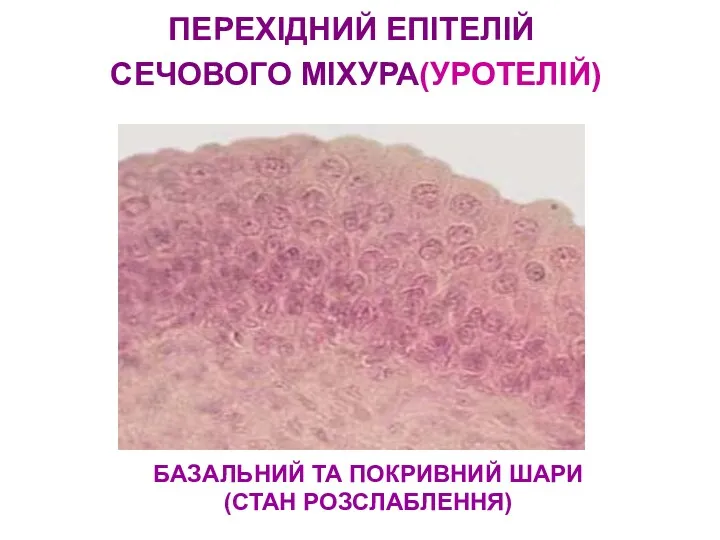 БАЗАЛЬНИЙ ТА ПОКРИВНИЙ ШАРИ (СТАН РОЗСЛАБЛЕННЯ) ПЕРЕХІДНИЙ ЕПІТЕЛІЙ СЕЧОВОГО МІХУРА(УРОТЕЛІЙ)