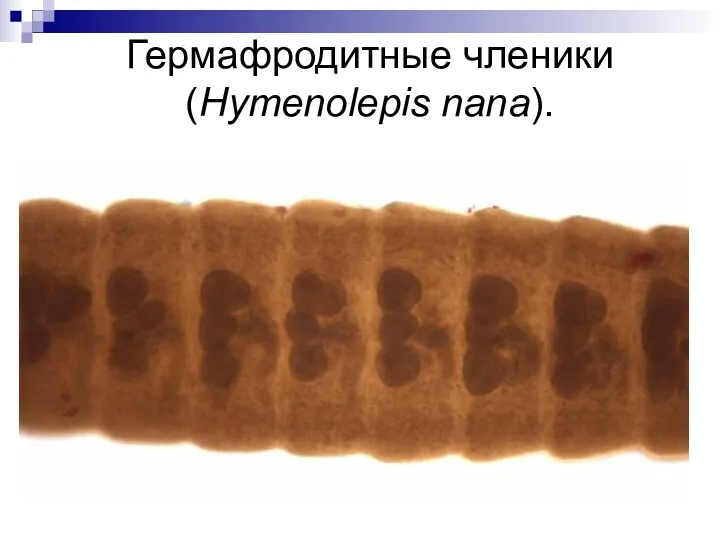 Гермафродитные членики (Hymenolepis nana).