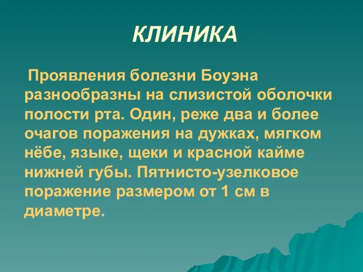 КЛИНИКА Проявления болезни Боуэна разнообразны на слизистой оболочки полости рта.