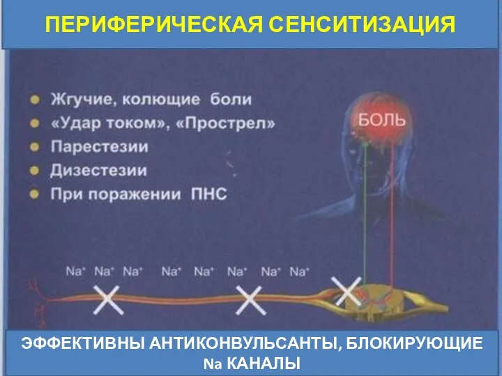 ПЕРИФЕРИЧЕСКАЯ СЕНСИТИЗАЦИЯ ЭФФЕКТИВНЫ АНТИКОНВУЛЬСАНТЫ, БЛОКИРУЮЩИЕ Na КАНАЛЫ