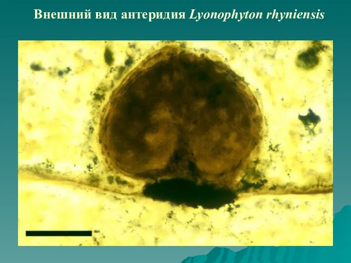 Внешний вид антеридия Lyonophyton rhyniensis