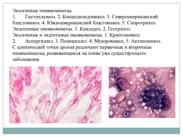 Экзогенные пневмомикозы. 1. Гистоплазмоз. 2. Кокцидиоидомикоз. 3. Североамериканский бластомикоз. 4.