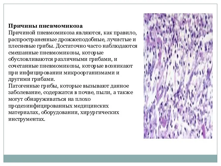 Причины пневмомикоза Причиной пневмомикоза являются, как правило, распространенные дрожжеподобные, лучистые