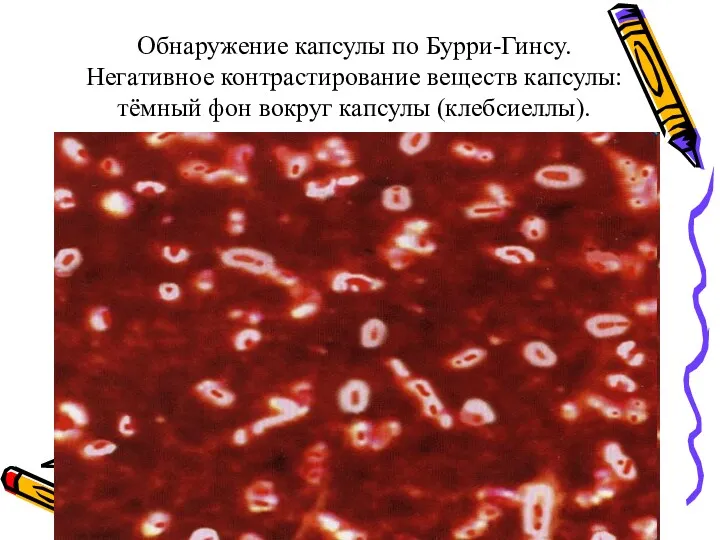 Обнаружение капсулы по Бурри-Гинсу. Негативное контрастирование веществ капсулы: тёмный фон вокруг капсулы (клебсиеллы).