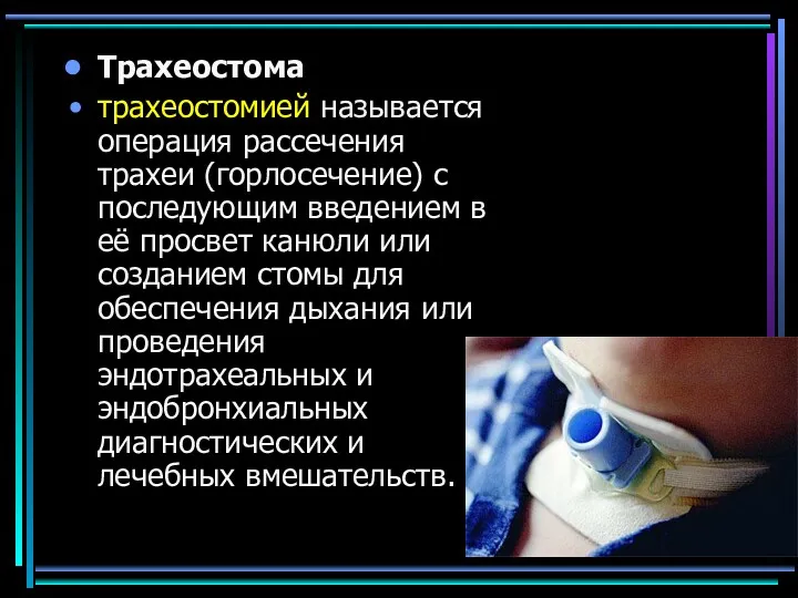 Трахеостома трахеостомией называется операция рассечения трахеи (горлосечение) с последующим введением в её просвет