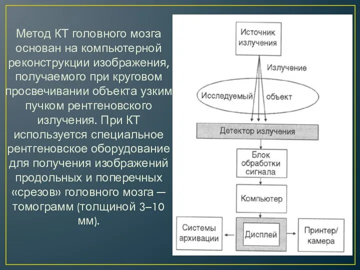 Метод КТ головного мозга основан на компьютерной реконструкции изображения, получаемого