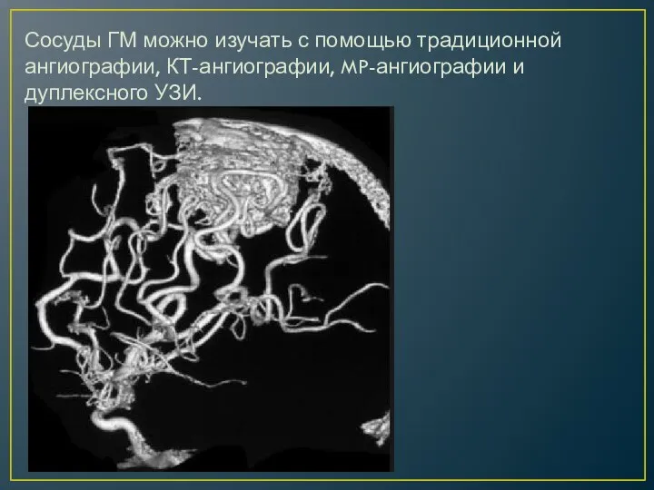 Сосуды ГМ можно изучать с помощью традиционной ангиографии, КТ-ангиографии, MP-ангиографии и дуплексного УЗИ. КТ-ангиография