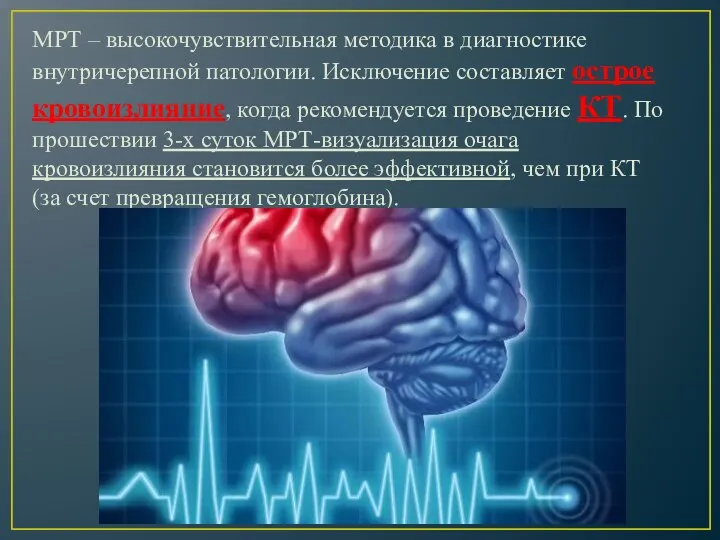 МРТ – высокочувствительная методика в диагностике внутричерепной патологии. Исключение составляет