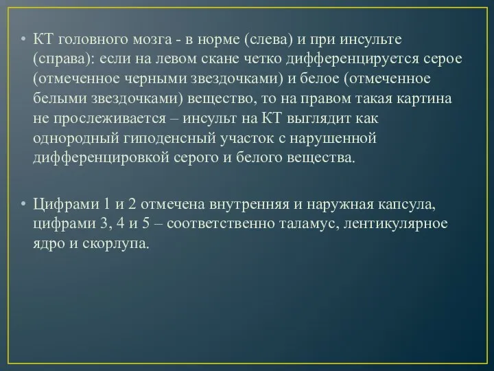 КТ головного мозга - в норме (слева) и при инсульте