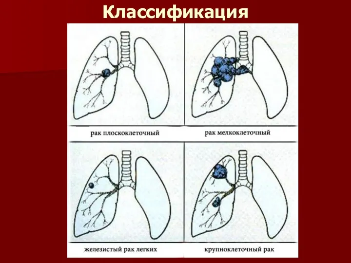 Классификация