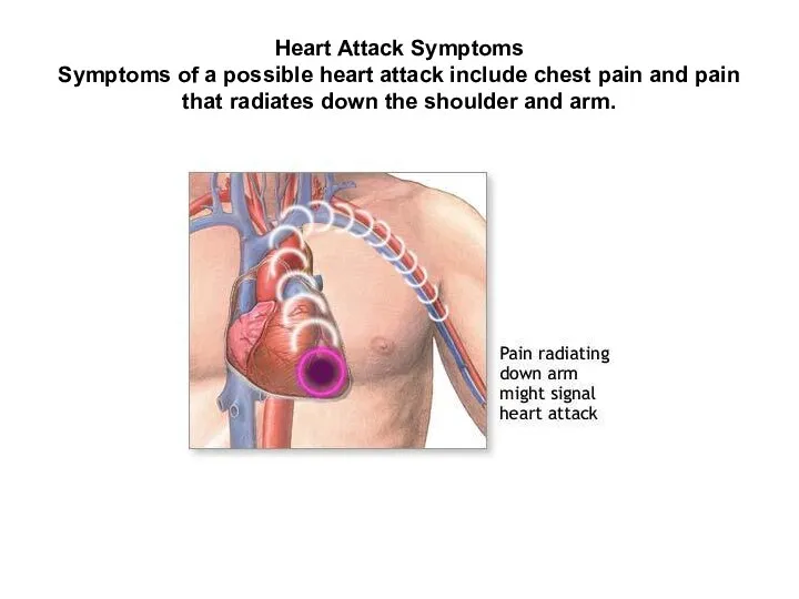 Heart Attack Symptoms Symptoms of a possible heart attack include chest pain and