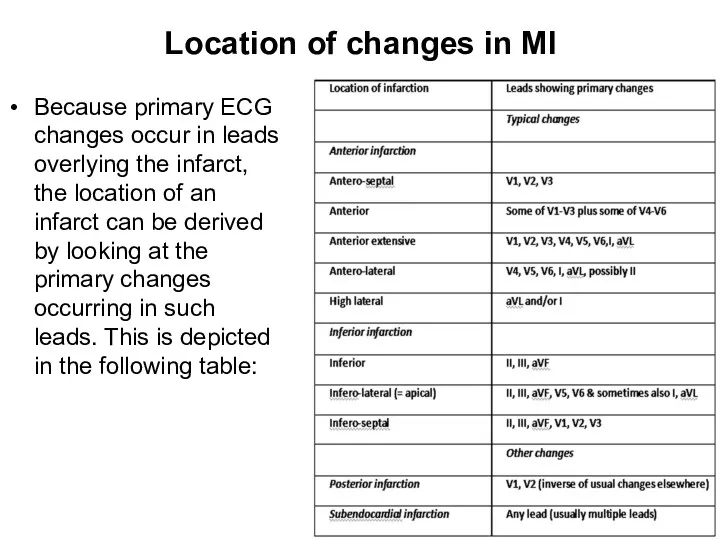 Location of changes in MI Because primary ECG changes occur in leads overlying