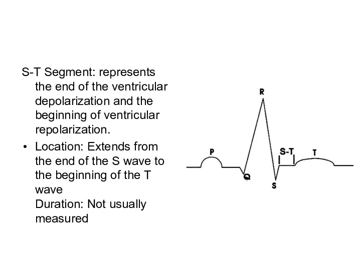 S-T Segment: represents the end of the ventricular depolarization and the beginning of