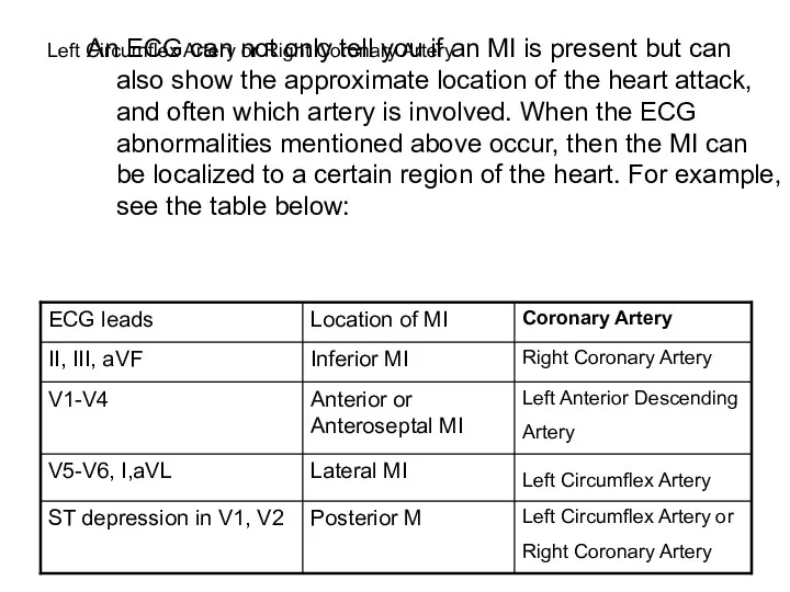 Left Circumflex Artery or Right Coronary Artery An ECG can not only tell