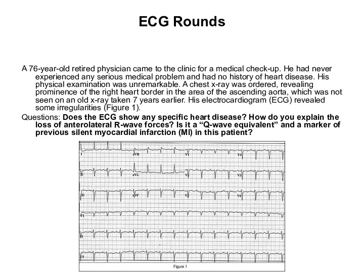 ECG Rounds A 76-year-old retired physician came to the clinic for a medical