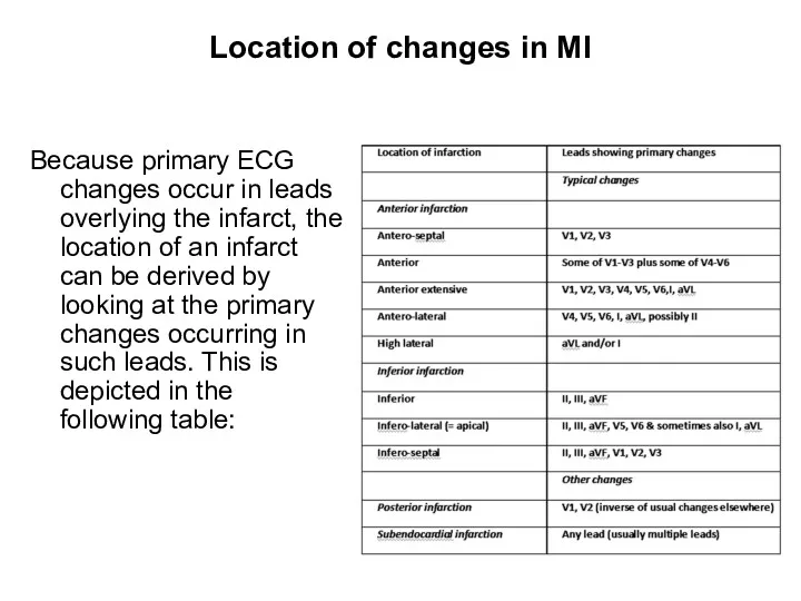 Location of changes in MI Because primary ECG changes occur in leads overlying