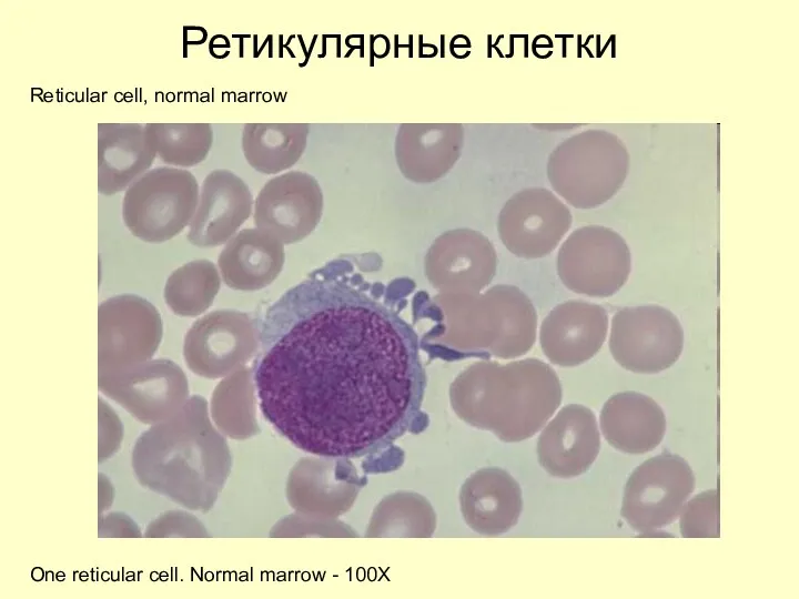 Ретикулярные клетки Reticular cell, normal marrow One reticular cell. Normal marrow - 100X