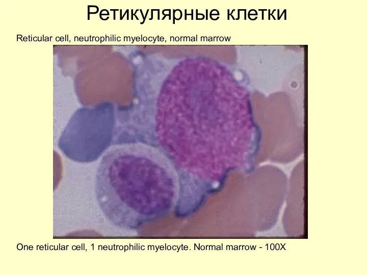 Ретикулярные клетки Reticular cell, neutrophilic myelocyte, normal marrow One reticular