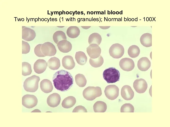 Lymphocytes, normal blood Two lymphocytes (1 with granules); Normal blood - 100X