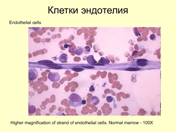 Клетки эндотелия Endothelial cells Higher magnification of strand of endothelial cells. Normal marrow - 100X