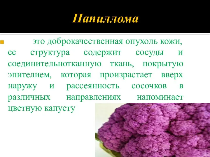 это доброкачественная опухоль кожи, ее структура содержит сосуды и соединительнотканную