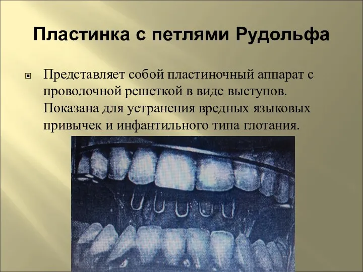 Пластинка с петлями Рудольфа Представляет собой пластиночный аппарат с прово­лочной