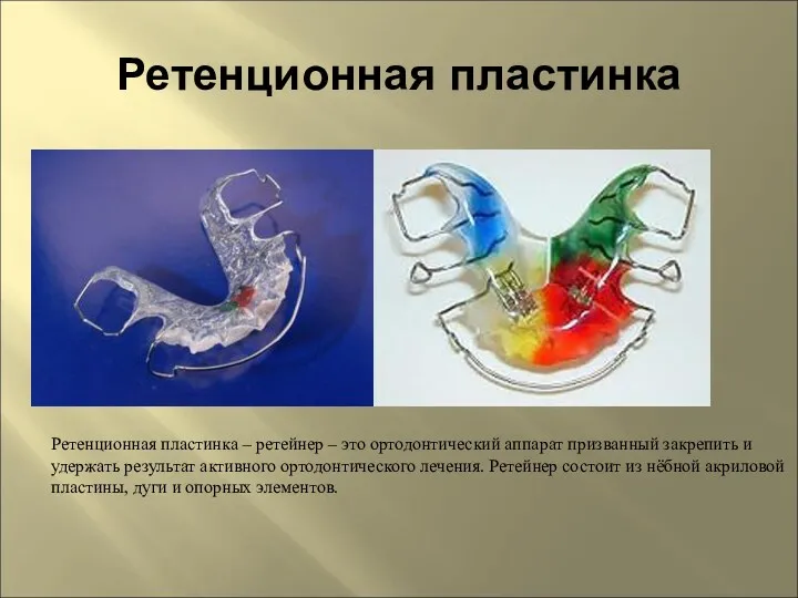 Ретенционная пластинка Ретенционная пластинка – ретейнер – это ортодонтический аппарат