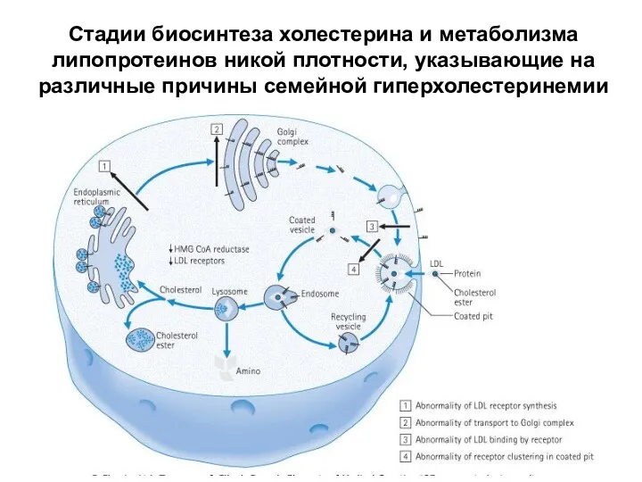 Стадии биосинтеза холестерина и метаболизма липопротеинов никой плотности, указывающие на различные причины семейной гиперхолестеринемии