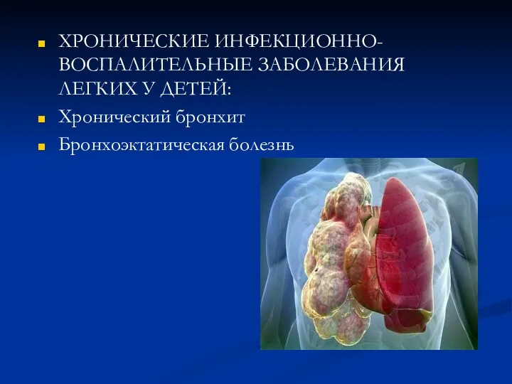 ХРОНИЧЕСКИЕ ИНФЕКЦИОННО-ВОСПАЛИТЕЛЬНЫЕ ЗАБОЛЕВАНИЯ ЛЕГКИХ У ДЕТЕЙ: Хронический бронхит Бронхоэктатическая болезнь