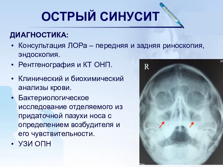 ОСТРЫЙ СИНУСИТ ДИАГНОСТИКА: Консультация ЛОРа – передняя и задняя риноскопия,