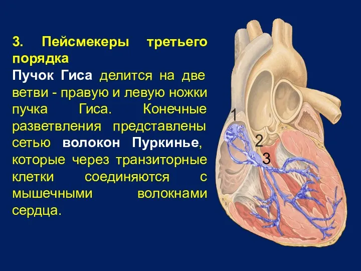 3. Пейсмекеры третьего порядка Пучок Гиса делится на две ветви