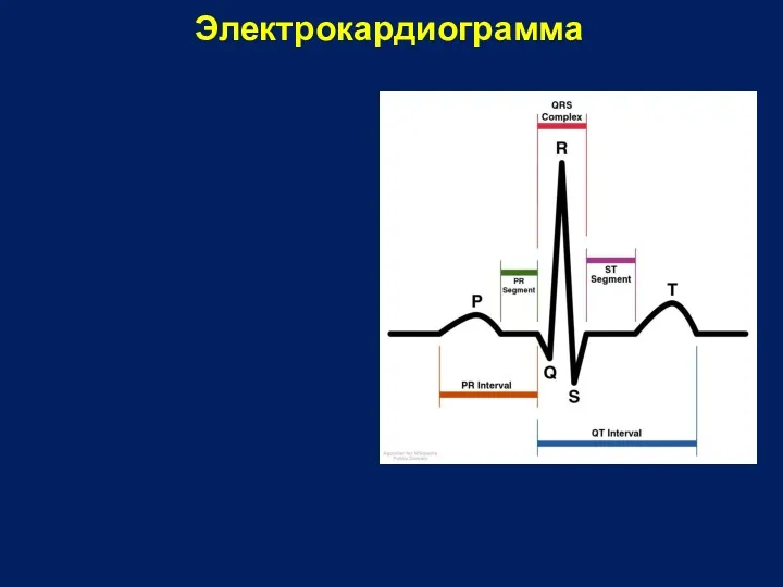 Электрокардиограмма