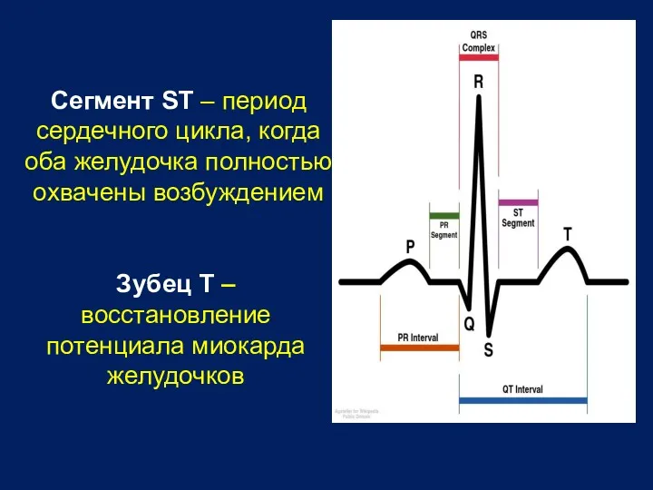 Сегмент ST – период сердечного цикла, когда оба желудочка полностью