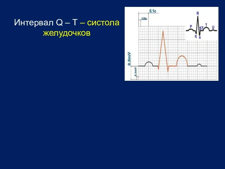 Интервал Q – T – систола желудочков