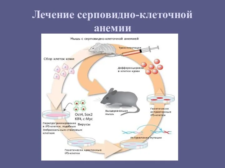 Лечение серповидно-клеточной анемии