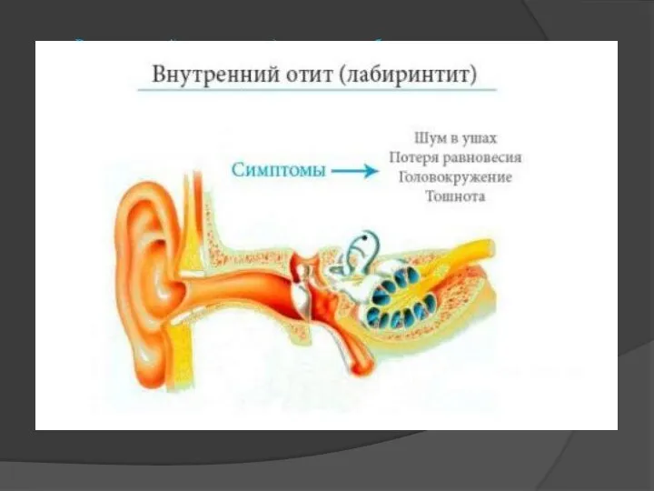 Внутренний отит в подавляющем большинстве случаев тоже не является самостоятельным