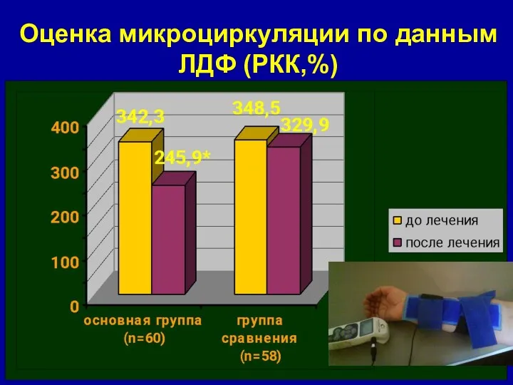 Оценка микроциркуляции по данным ЛДФ (РКК,%)