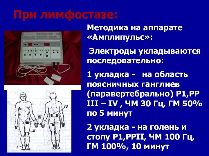 При лимфостазе: Методика на аппарате «Амплипульс»: Электроды укладываются последовательно: 1