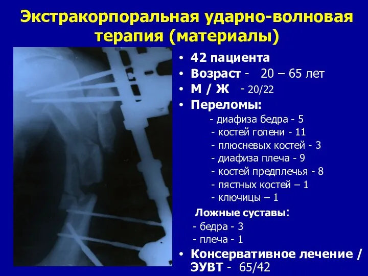 Экстракорпоральная ударно-волновая терапия (материалы) 42 пациента Возраст - 20 –