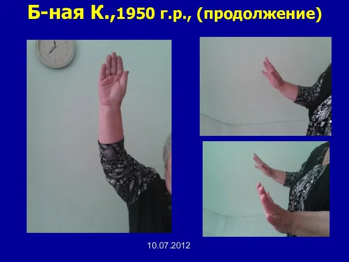 Б-ная К.,1950 г.р., (продолжение) 10.07.2012