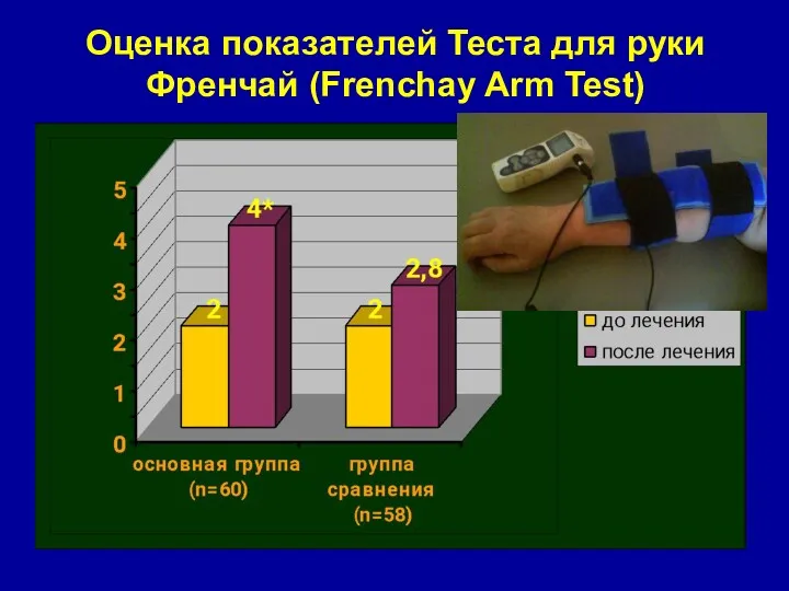 Оценка показателей Теста для руки Френчай (Frenchay Arm Test)