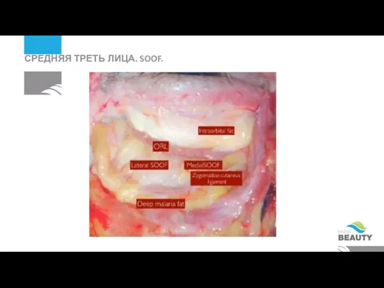 СРЕДНЯЯ ТРЕТЬ ЛИЦА. SOOF.