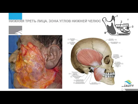 НИЖНЯЯ ТРЕТЬ ЛИЦА. ЗОНА УГЛОВ НИЖНЕЙ ЧЕЛЮСТИ.