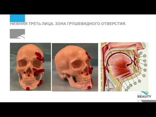 НИЖНЯЯ ТРЕТЬ ЛИЦА. ЗОНА ГРУШЕВИДНОГО ОТВЕРСТИЯ.