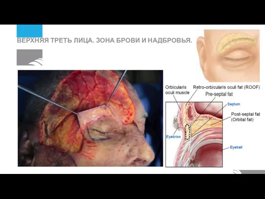 ВЕРХНЯЯ ТРЕТЬ ЛИЦА. ЗОНА БРОВИ И НАДБРОВЬЯ.