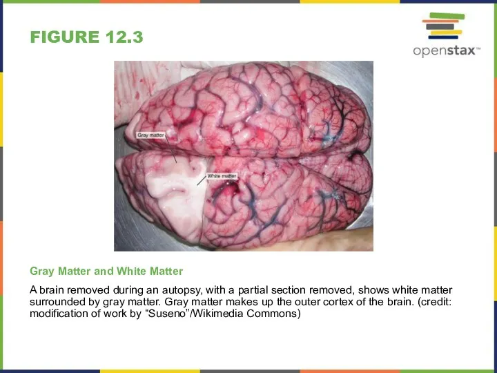 FIGURE 12.3 Gray Matter and White Matter A brain removed
