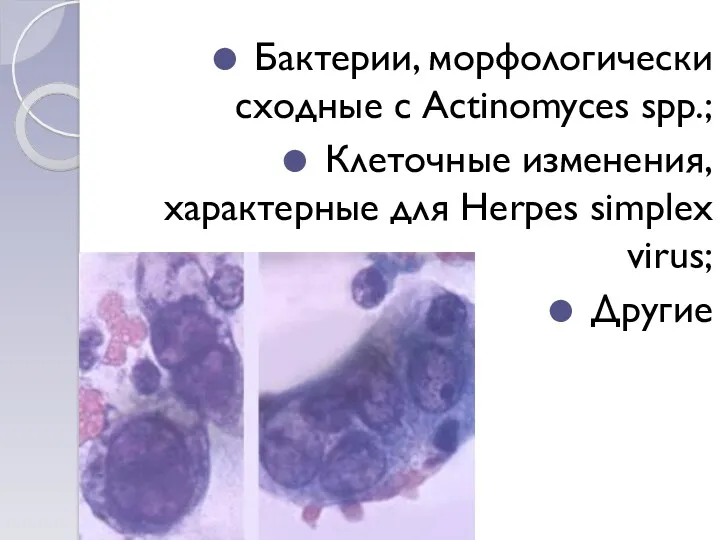 Бактерии, морфологически сходные с Actinomyces spp.; Клеточные изменения, характерные для Herpes simplex virus; Другие