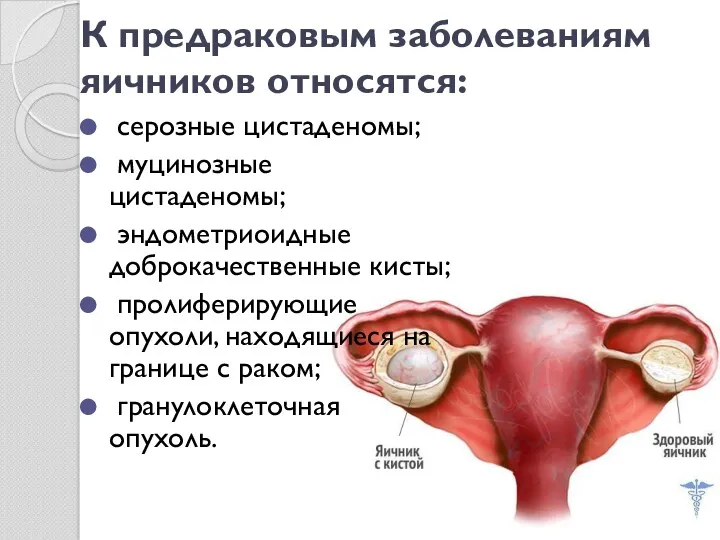 К предраковым заболеваниям яичников относятся: серозные цистаденомы; муцинозные цистаденомы; эндометриоидные